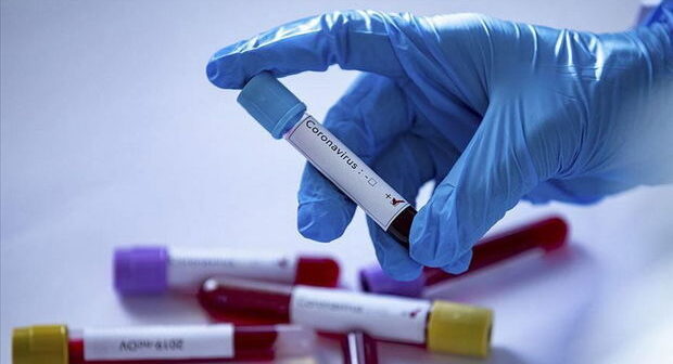 Süni koronavirus yaradıldı