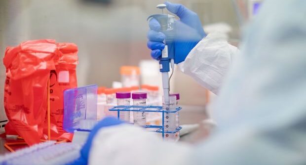 Azərbaycanda daha 76 nəfərdə koronavirus aşkarlandı – RƏSMİ