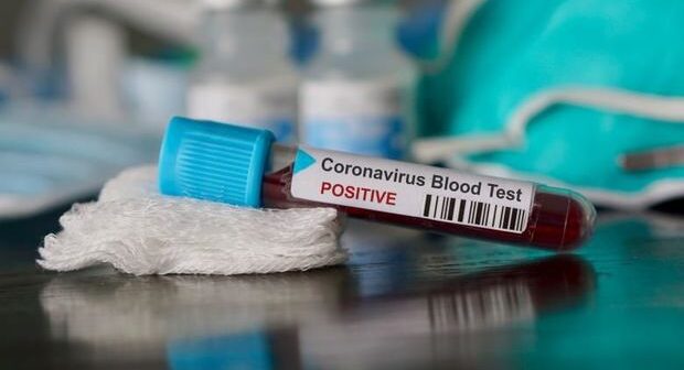 Bakıya gətirilən 29 azərbaycanlıda koronavirus aşkarlandı – RƏSMİ