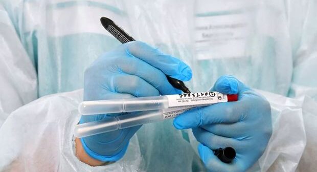 ATV-nin əməkdaşlarının koronavirus testi neqativ çıxdı