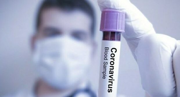 Türkiyə koronavirus daşıyıcılarını bu üsulla tapacaq