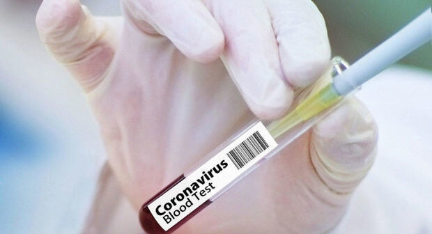 Sinqapurda 357 nəfərə yanlışlıqla koronavirus diaqnozu qoyuldu