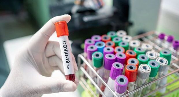 Koronavirusla bağlı SON STATİSTİKA
