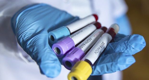 Bu gün Azərbaycanda daha 352 nəfərdə koronavirus aşkarlandı, iki nəfər vəfat etdi
