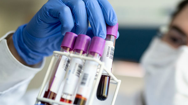 ÜST: “Mutasiyaya uğrayan koronavirus təhlükə yaratmır”