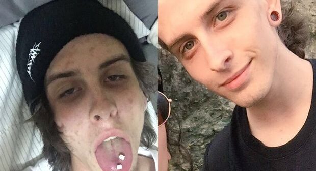 Narkotik asılılığından qurtulan gənc görünüşü ilə təəccübləndirdi – FOTO