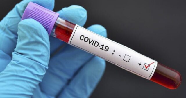 Agentlik: Koronavirus testinin nəticələri haqqında göndərilən məlumatda yanlışlıq olub