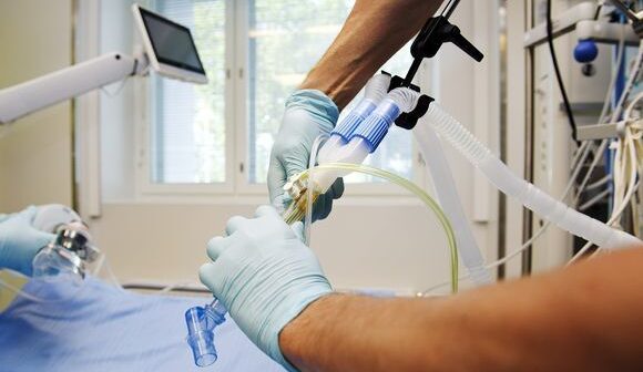Süni tənəffüz cihazına qoşulan koronavirus xəstələrinin sayı bilindi