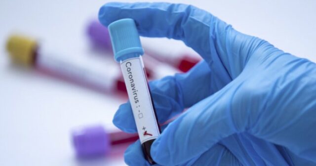 Koronavirus: Azərbaycanda sutkalıq yoluxma və sağalma sayı açıqlanıb