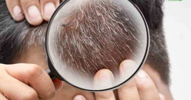 Saçlarımız niyə ağarır? – Araşdırma