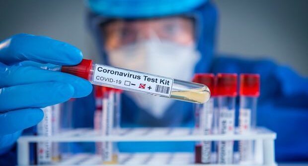 Azərbaycanda koronavirusa yoluxanların sayı sağalanları üstələdi: Bir nəfər öldü – FOTO