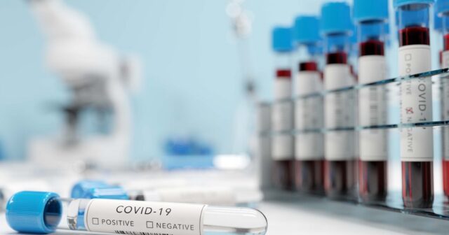Koronavirusa qarşı immunitet 1 ay sonra təsirini itirir