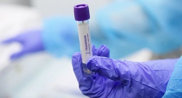 Azərbaycanda koronavirusa yoluxma sayı 100-dən aşağı düşdü: İki nəfər öldü – FOTO