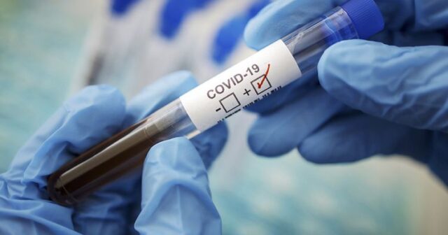 Rusiya əhalisinin 0.6 faizi koronavirusa yoluxub