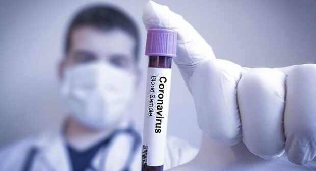 Dünyada koronavirusa yoluxanların sayı