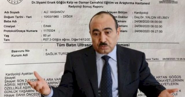 Əli Həsənov Klivlendə gedir – Özü açıqlama yaydı