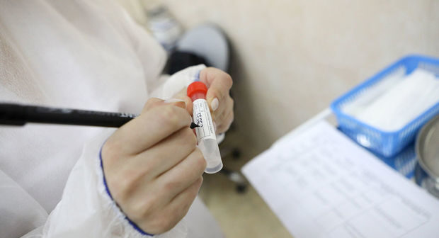 Dünyada son sutkada 121 733 nəfər koronavirusa yoluxub