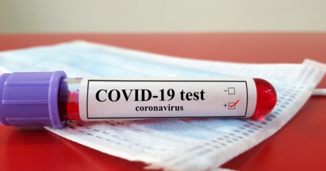 Azərbaycanda daha 603 nəfər koronavirusa yoluxub, 6 nəfər ölüb