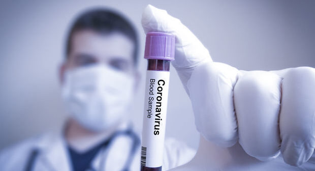 Azərbaycanda daha 1 614 nəfər koronavirusa yoluxub, 16 nəfər ölüb