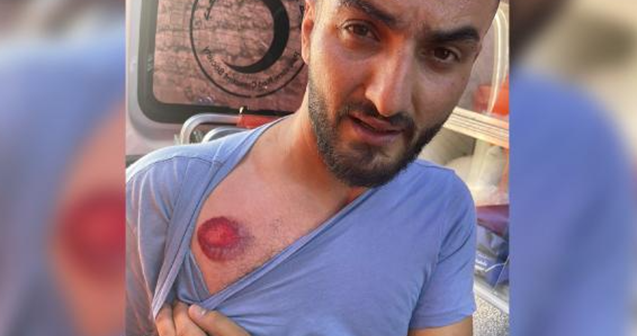 İsrail-Fələstin qarşıdurmasında türkiyəli jurnalist yaralandı