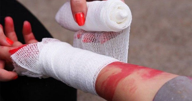 Oğurluğa görə “əl kəsmək” cəzası BƏRPA OLUNUR