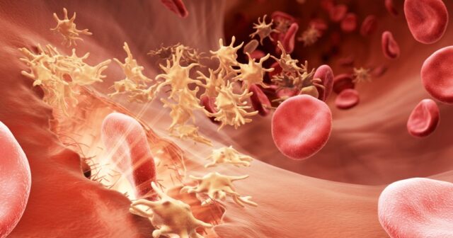 Azərbaycanda hemofiliya xəstələrinin sayı açıqlandı