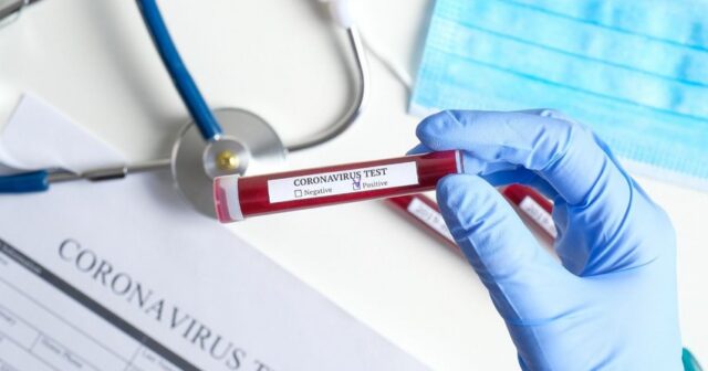 Azərbaycanda daha 1 151 nəfər koronavirusa yoluxub, 9 nəfər ölüb