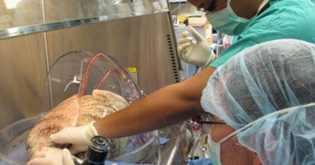 Tibbdə ilk: universal donor ağciyəri yaradıldı