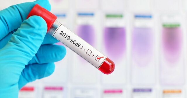 Azərbaycanda koronavirusa yoluxanların sayı 700 mini ötdü