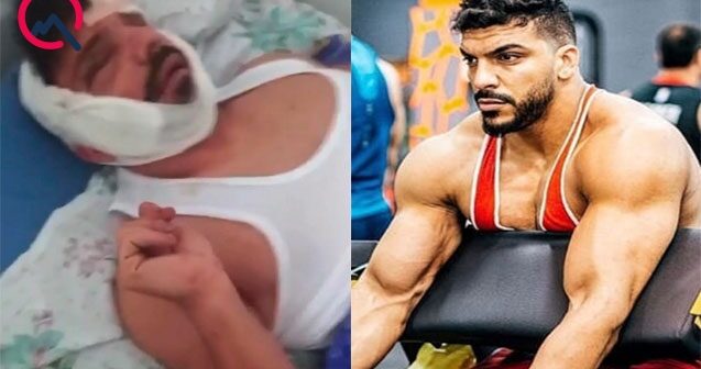 Gecə klubunda partlayışda ağır yaralanan çempionun xəstəxanadan – FOTOSU