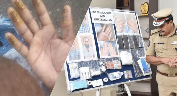 Hindistanda yenidən viza ala bilmək üçün barmaq izlərini dəyişdirdilər – FOTO
