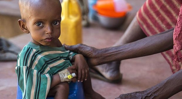 Somalidə 500 min uşaq ölüm riski ilə üz-üzədir