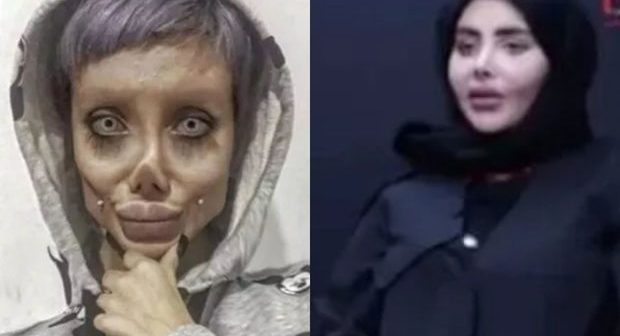 Həbsdən çıxan “Zombi Ancelina” hamını aldadıbmış: Efirdə etiraf etdi – FOTO