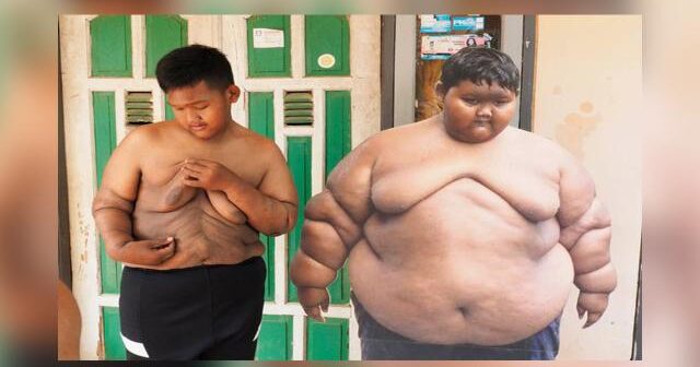 Dünyanın ən kök uşağı 114 kilo arıqlayıb