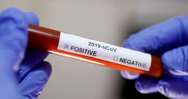 Azərbaycanda koronavirus xəstələrinin sayı 9 nəfərdir