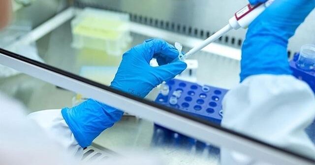 Türkiyədə hepatitə yoluxma halları azalıb