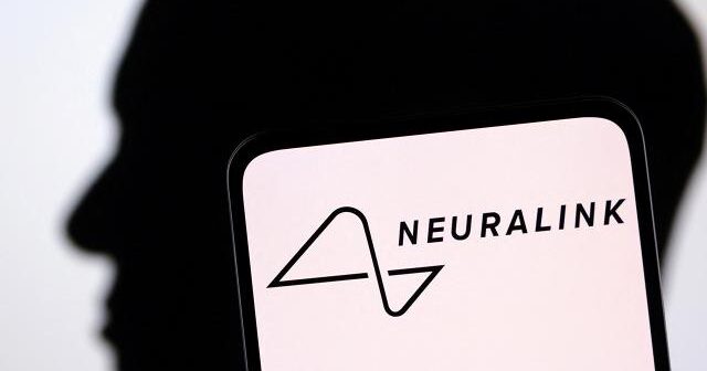 İlon Maskın Neuralink beyin implantı üçün insan sınaqlarına başlayır