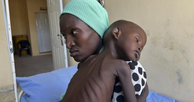 Nigeriyada 10 ayda difteriya epidemiyasından 600-dən çox adam ölüb