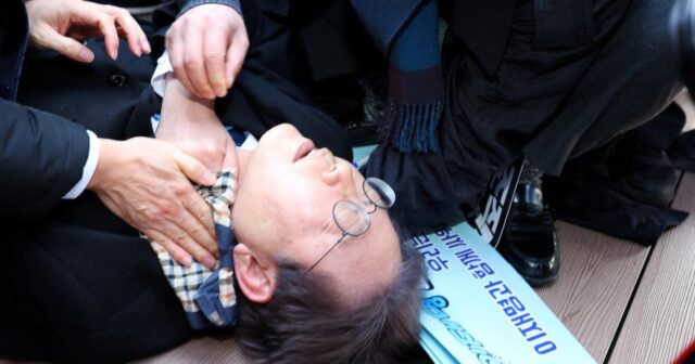 Cənubi Koreyada bıçaqla hücuma məruz qalan müxalifət lideri buraxılıb