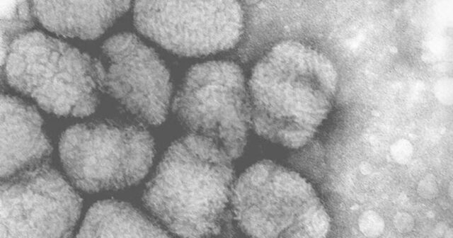 Alyaskapox virusundan ilk ölüm qeydə alınıb