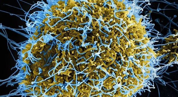 Çin alimləri laboratoriyada mutasiyaya uğramış Ebola virusu YARATDILAR