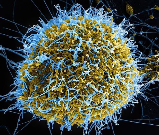 Çin alimləri laboratoriyada mutasiyaya uğramış Ebola virusu YARATDILAR