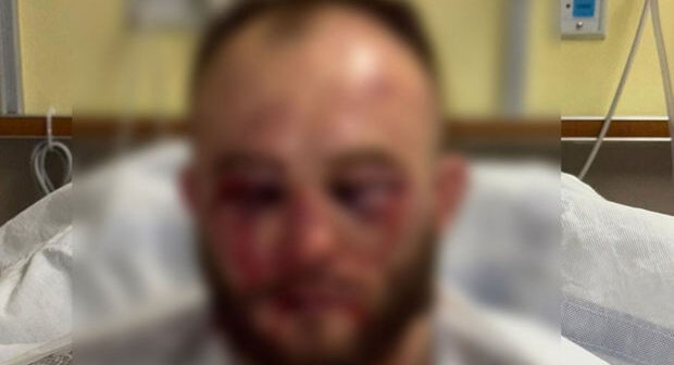 UFC ulduzunu tanınmaz hala gətirən nokaut: Xəstəxanadan son vəziyyətini paylaşdı – FOTO
