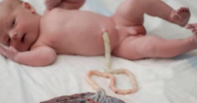Ata yeni doğulmuş oğlunun göbəyini dişləyərək az qala ÖLDÜRƏCƏKDİ