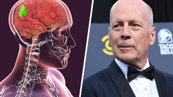 Hollivud ulduzunun ailəsindən AĞIR QƏRAR: Aktyorun beyni tədqiqata veriləcək – FOTO Hollivud ulduzunun ailəsindən AĞIR QƏRAR: Aktyorun beyni tədqiqata veriləcək – FOTO