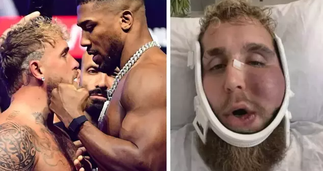 Məşhur bloqerin üzü tanınmaz hala DÜŞDÜ: Çənəsi iki yerdən SINDI – FOTO/VİDEO