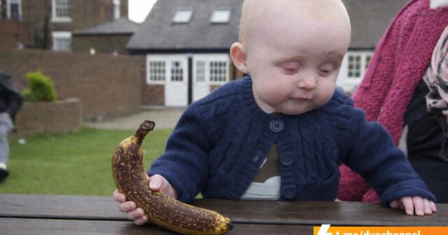 Həkimlər banan yeyənlərə SƏSLƏNDİ: Qaralmış meyvələrdən uzaq durun