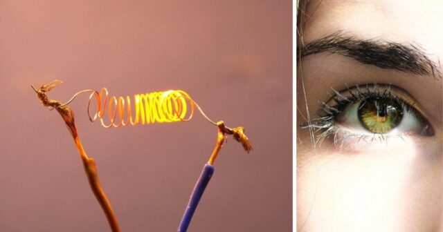 Lazersiz göz əməliyyatı MÜMKÜN OLUR: Alimlər zəif elektrik cərəyanı ilə görməni BƏRPA EDİR