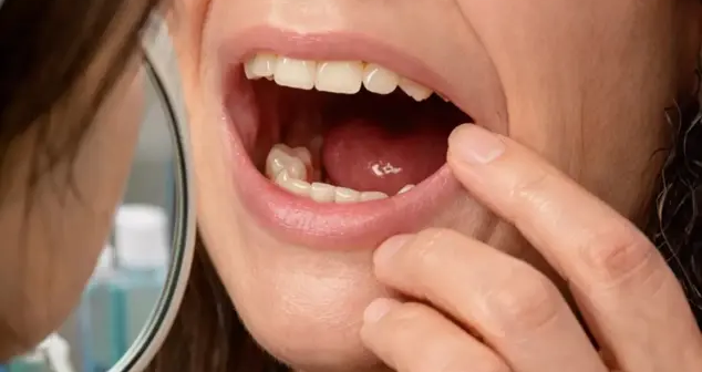 Nadir HADİSƏ: Həkimlər qadının ağciyərindən DİŞ ÇIXARDILAR – FOTO