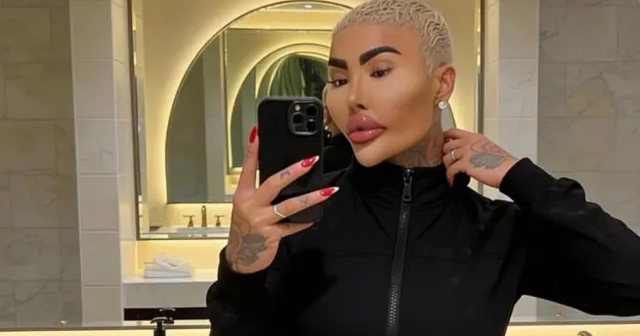 12 əməliyyat keçirən tanınmış bloqerin FACİƏVİ SONU: 59-cu prosedurda ÖLDÜ – FOTO 12 əməliyyat keçirən tanınmış bloqerin FACİƏVİ SONU: 59-cu prosedurda ÖLDÜ – FOTO